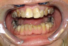discoloured before.JPG